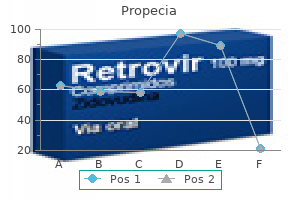 buy cheap propecia 1 mg on line