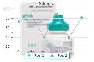 buy sildigra 25 mg on-line