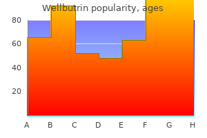 discount wellbutrin 300 mg free shipping