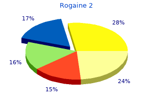 buy rogaine 2 60ml otc