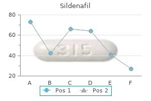 order sildenafil 75 mg free shipping