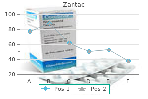 zantac 150 mg with mastercard