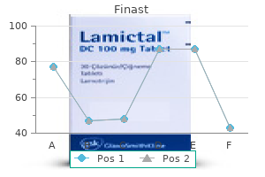 generic finast 5mg without prescription