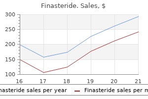 cheap 1 mg finasteride fast delivery