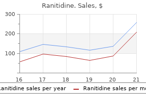 purchase 150mg ranitidine with mastercard