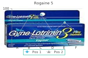 buy rogaine 5 60 ml cheap