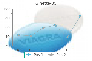 cheap 2mg ginette-35 with amex