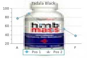 generic tadala black 80 mg on-line