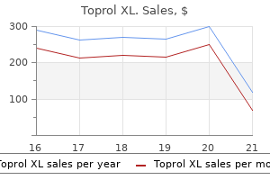 buy toprol xl 100 mg line