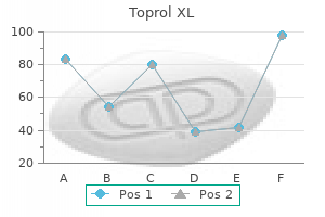 buy generic toprol xl 25mg on-line