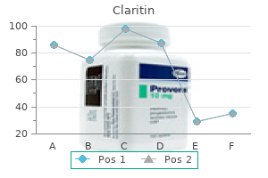 generic claritin 10mg